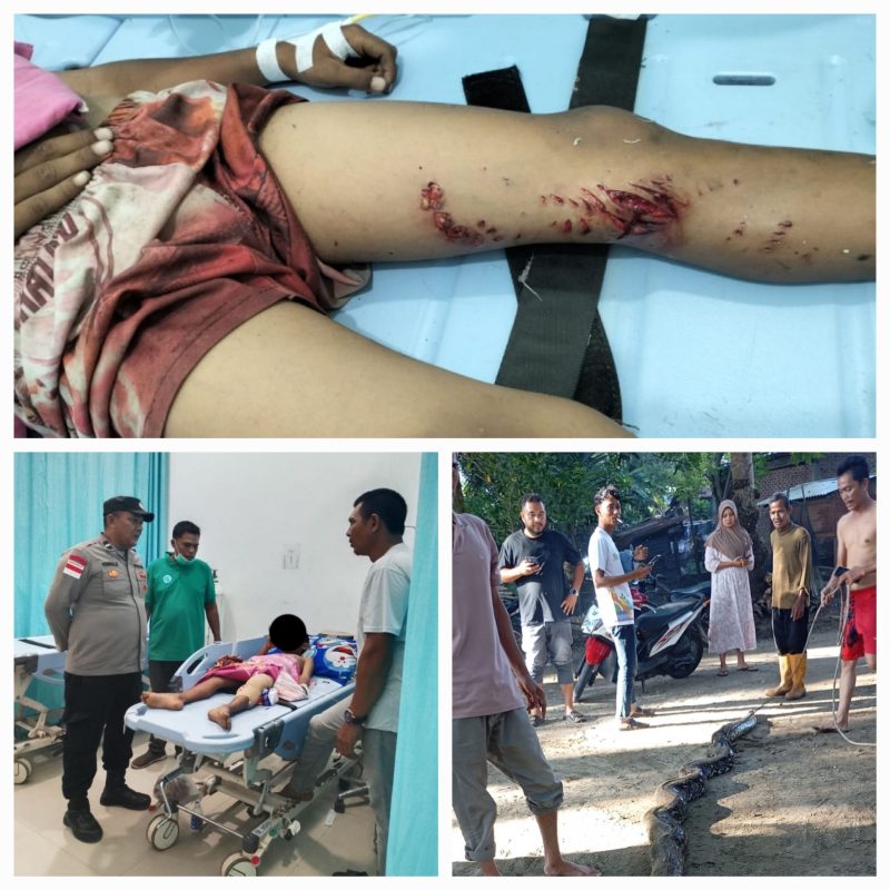 M. Iqbal, warga Gampong Suak Puntong, Kecamatan Kuala Pesisir, Kabupaten Nagan Raya, diserang ular phyton saat sedang memancing di rawa-rawa belakang rumahnya, Senin (5/1/2026) sore.